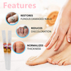 BLSEX 3ml*4 Nail Fungus Repair Essence Pen Repair Fingernail 25%Undecylenic Foot Nail Restores Care Of Appearance Discolored Tool