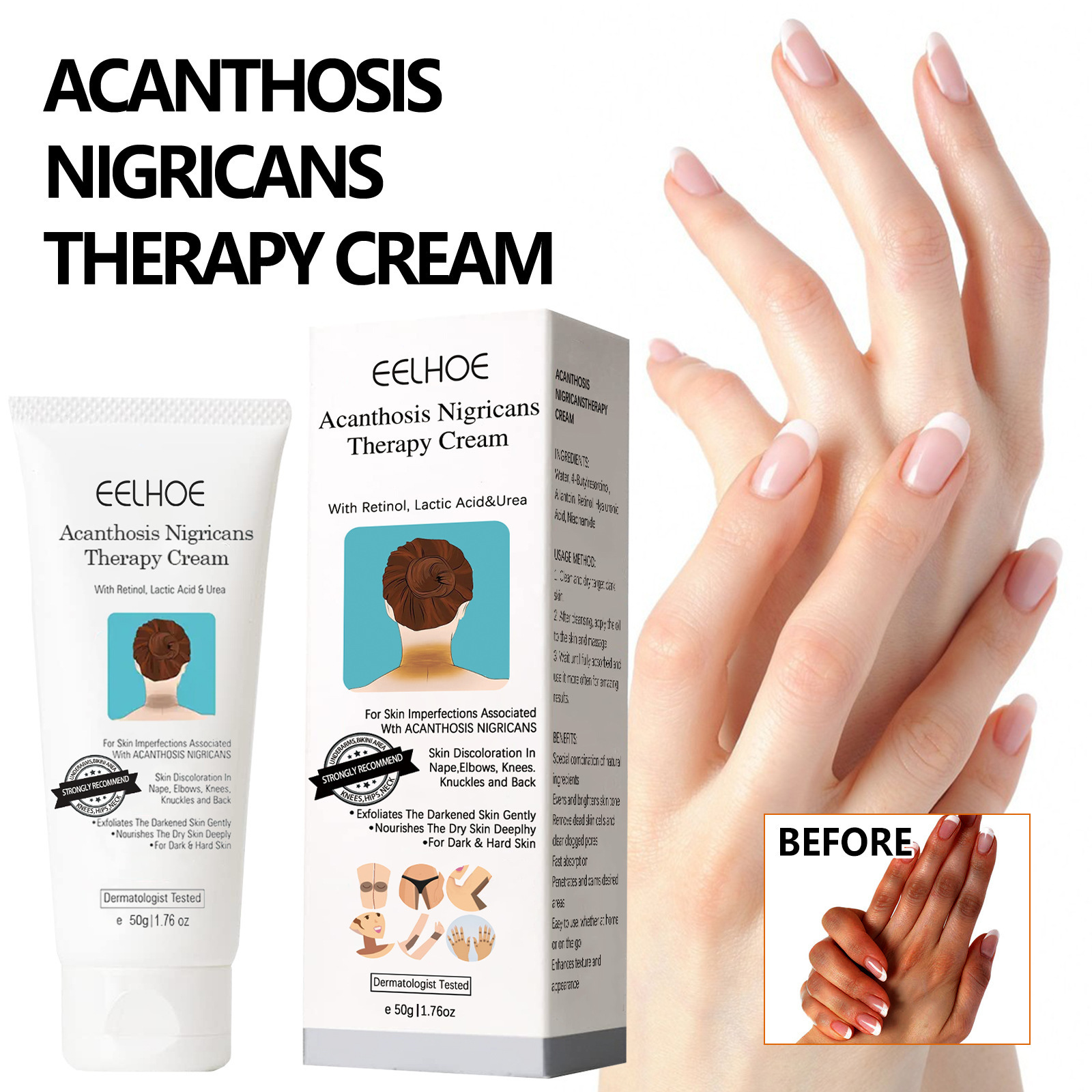 Black Scaly Skin Repair Cream - Moisturizing, Whitening and Repairing Cream for Underarms, Arms, Knees and Joints to Remove Dark Spots on the Body