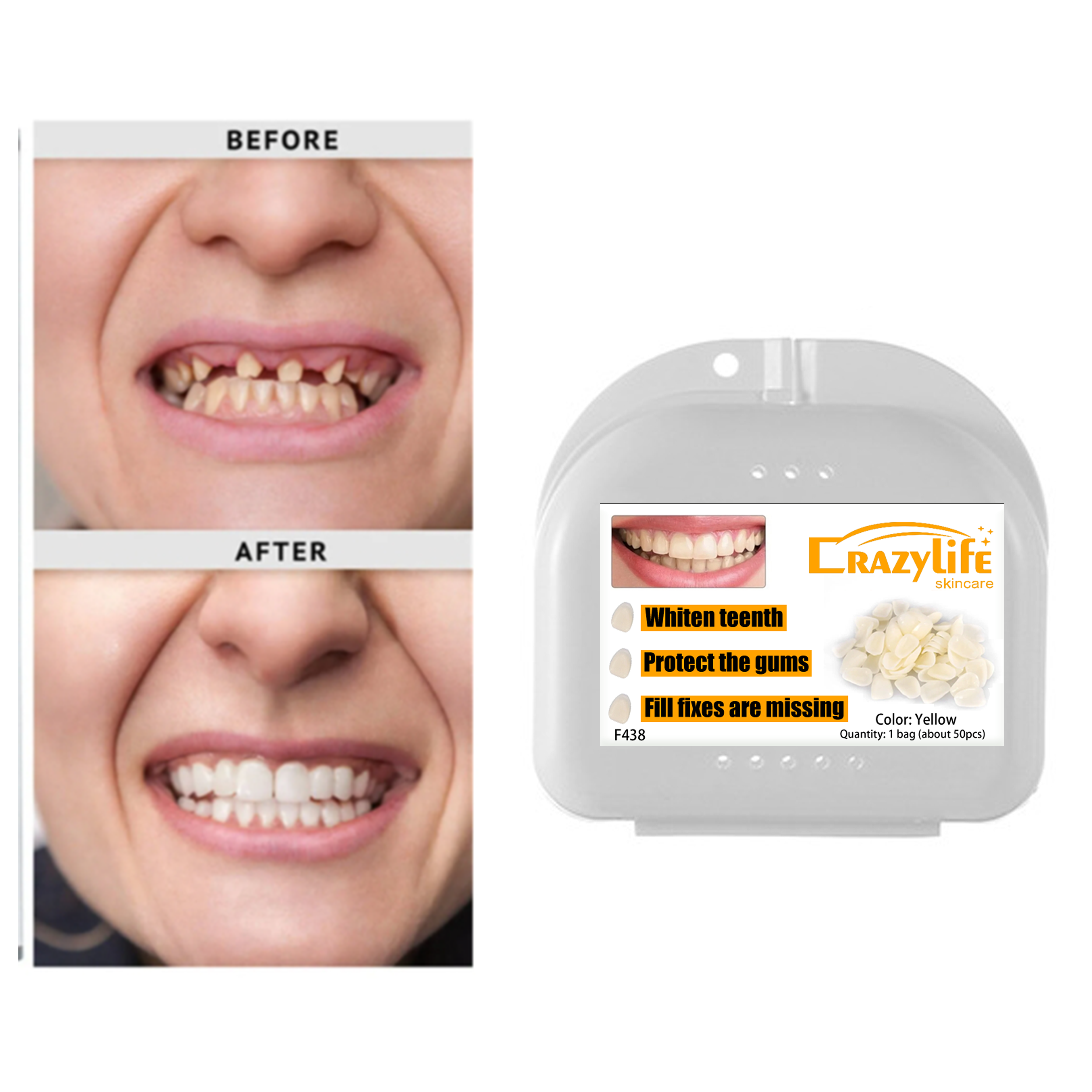 Crazylife Professional Temporary Clip-On Veneers / Dental Veneers Kit - Cosmetic Instant Smile Makeover, Stain-Resistant & Removable False Teeth Covers 